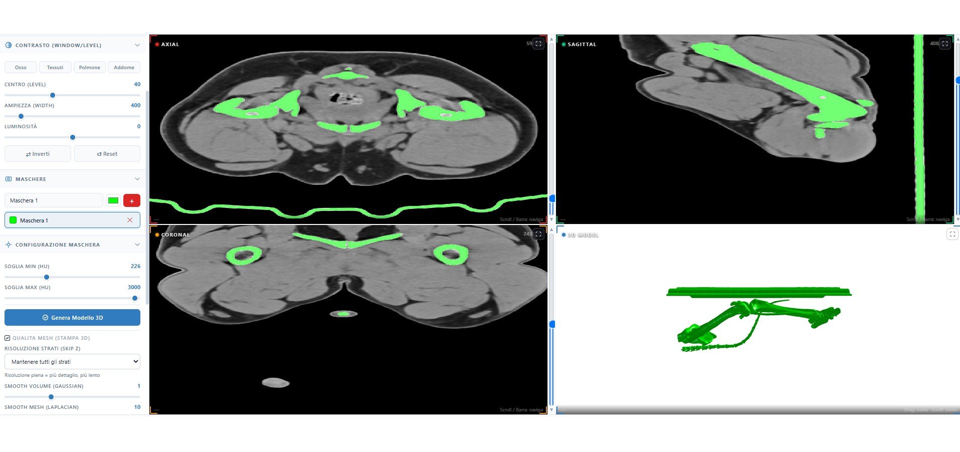 Interfaccia AIMED3D Anatomy durante la segmentazione di immagini diagnostiche