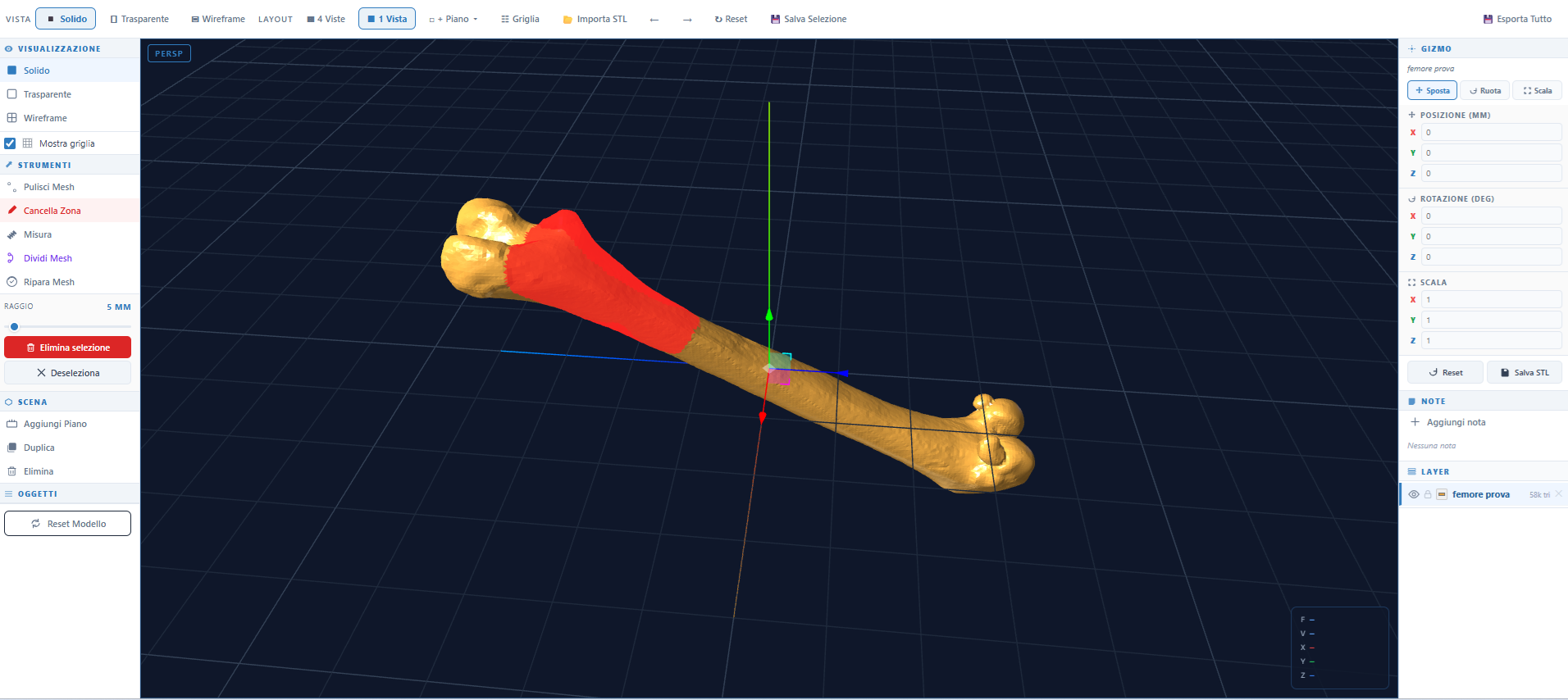 Interfaccia AIMED3D Design con strumento Cancella Zona su un modello di femore, pannello Gizmo e gestione layer