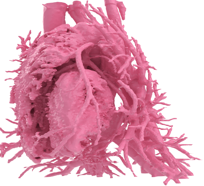 Modello 3D stampato di albero bronchiale e strutture vascolari toraciche