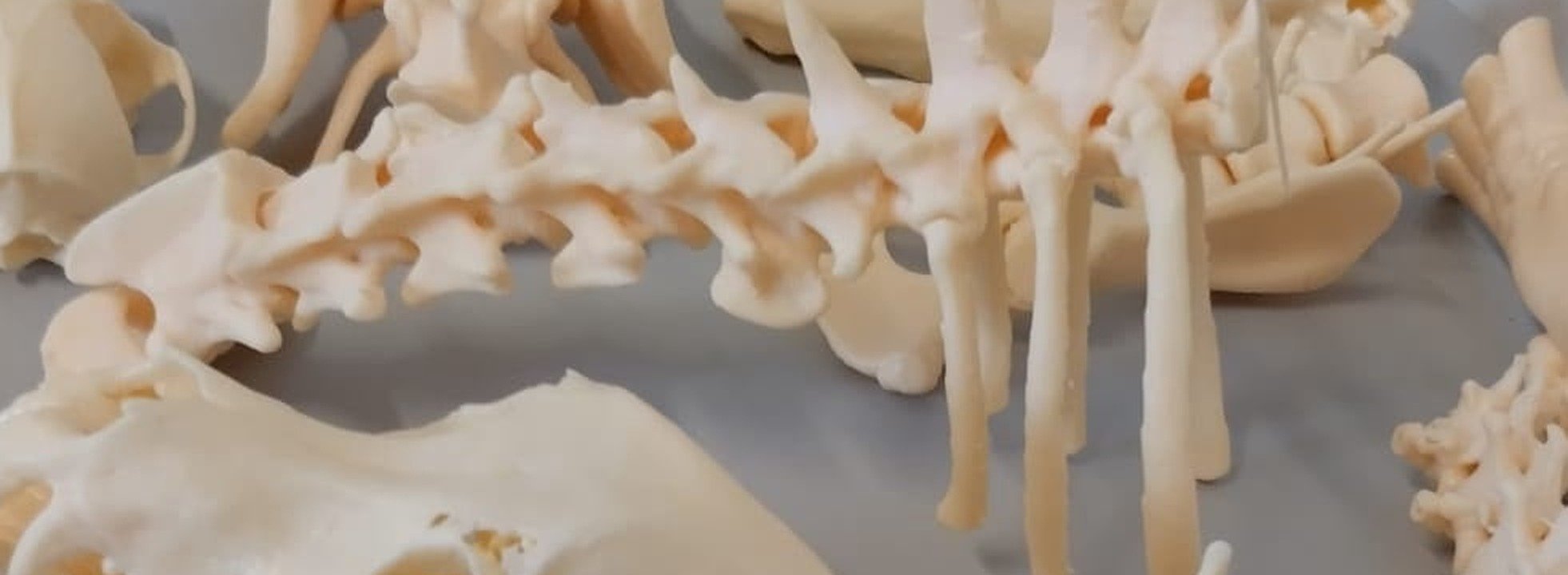 Vertebre e strutture anatomiche stampate in 3D per applicazioni mediche
