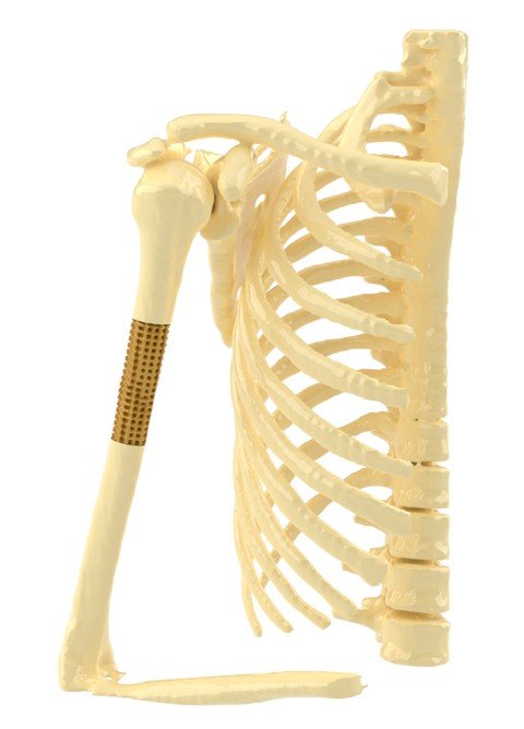 Scaffold stampato in 3D per la rigenerazione del tessuto osseo
